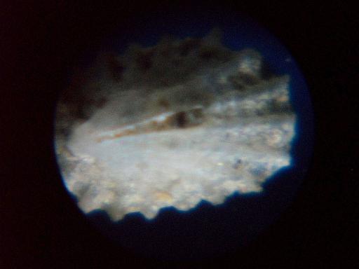 puncturella noachina?